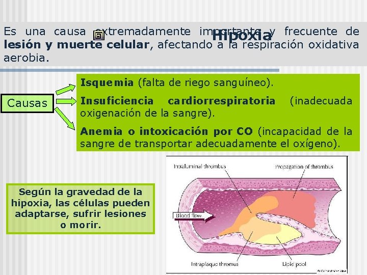 Es una causa extremadamente importante y frecuente de Hipoxia lesión y muerte celular, afectando