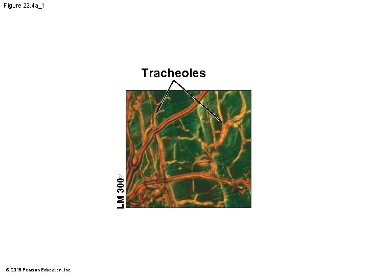 Figure 22. 4 a_1 LM 300× Tracheoles © 2018 Pearson Education, Inc. 