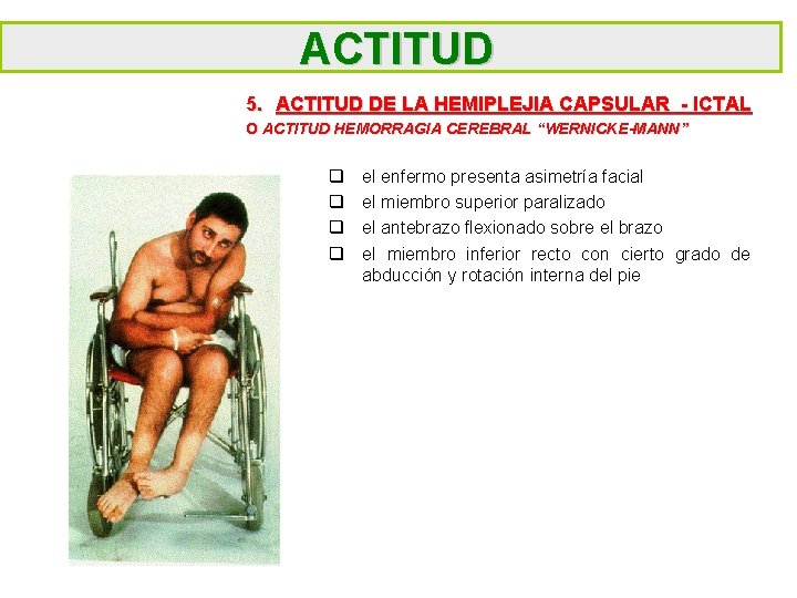 ACTITUD 5. ACTITUD DE LA HEMIPLEJIA CAPSULAR - ICTAL O ACTITUD HEMORRAGIA CEREBRAL “WERNICKE-MANN”