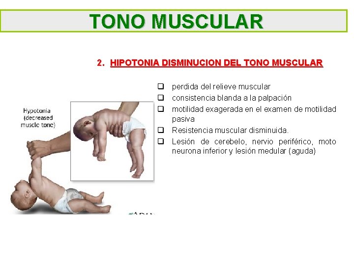 TONO MUSCULAR 2. HIPOTONIA DISMINUCION DEL TONO MUSCULAR q perdida del relieve muscular q