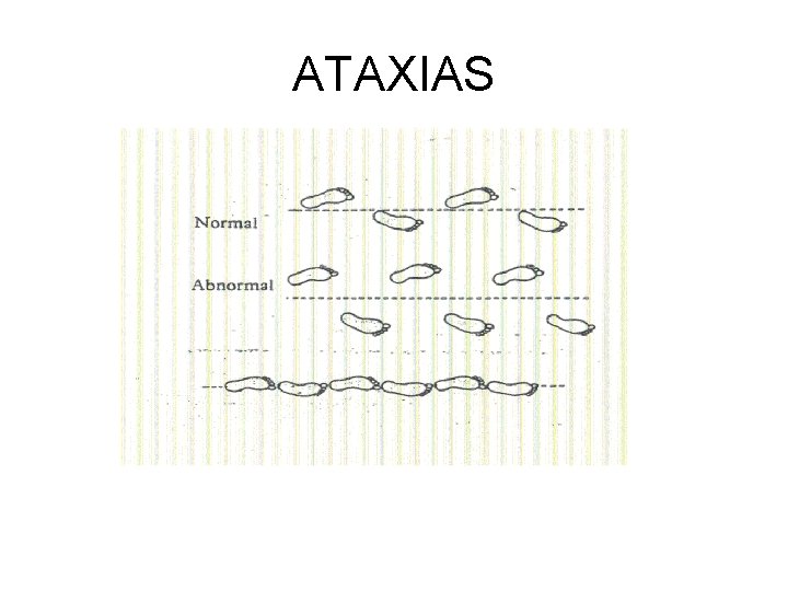 ATAXIAS 