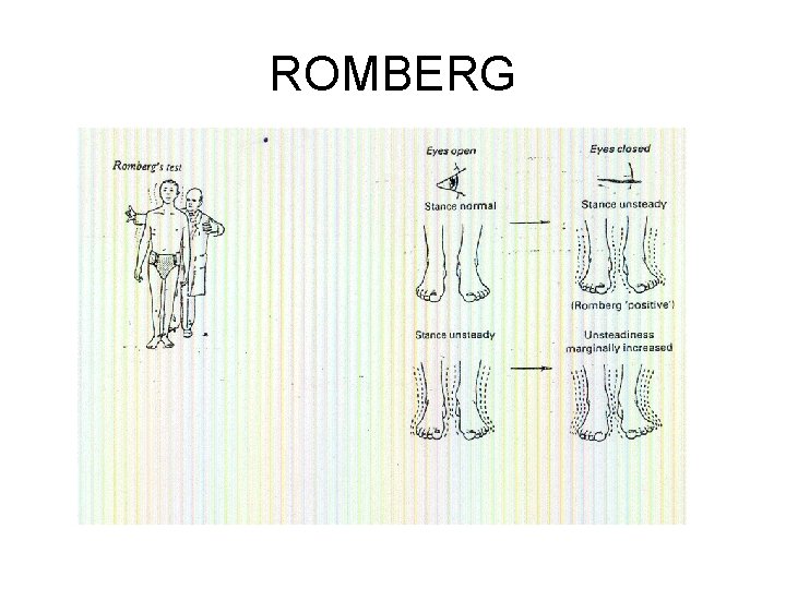 ROMBERG 