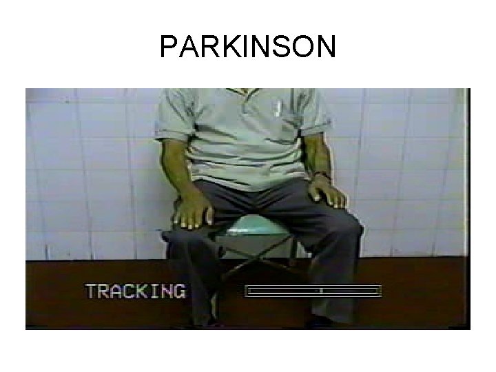 PARKINSON 