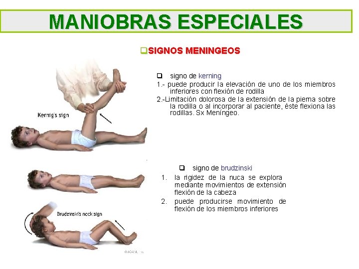 MANIOBRAS ESPECIALES q. SIGNOS MENINGEOS q signo de kerning 1. - puede producir la