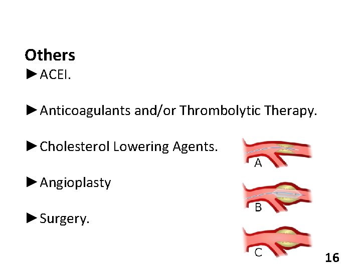 Others ►ACEI. ►Anticoagulants and/or Thrombolytic Therapy. ►Cholesterol Lowering Agents. ►Angioplasty ►Surgery. 16 