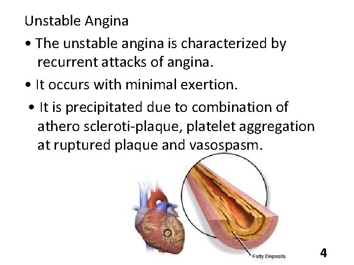Unstable Angina • The unstable angina is characterized by recurrent attacks of angina. •
