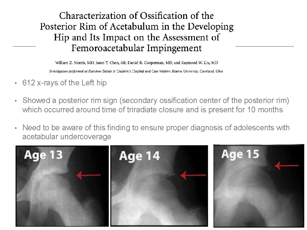  • 612 x-rays of the Left hip • Showed a posterior rim sign