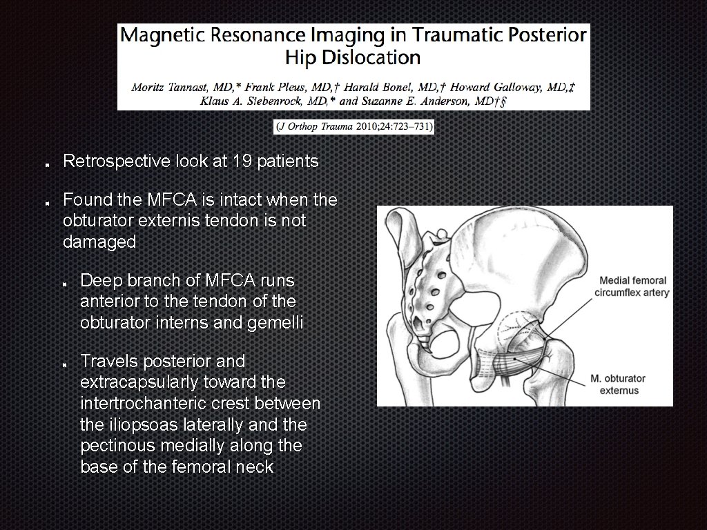 Retrospective look at 19 patients Found the MFCA is intact when the obturator externis
