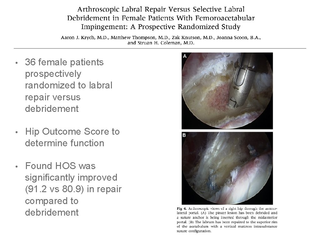  • 36 female patients prospectively randomized to labral repair versus debridement • Hip