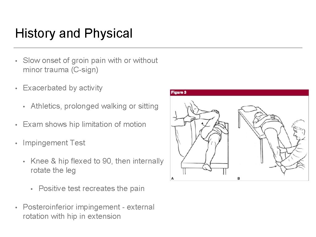 History and Physical • Slow onset of groin pain with or without minor trauma