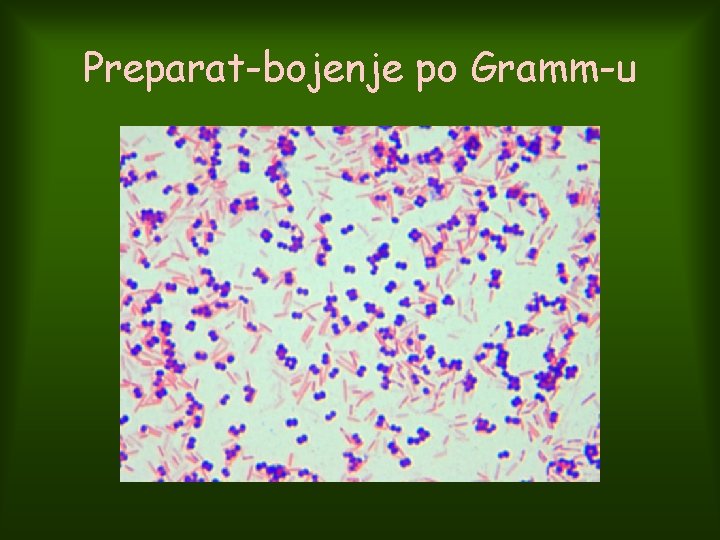 Preparat-bojenje po Gramm-u 