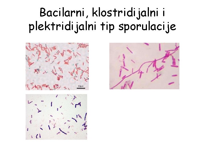 Bacilarni, klostridijalni i plektridijalni tip sporulacije 