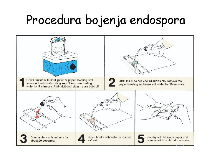 Procedura bojenja endospora 
