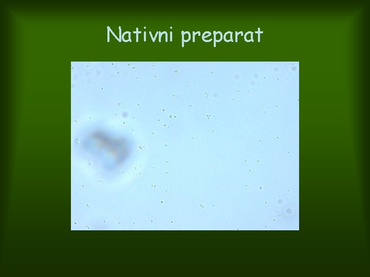 Nativni preparat 