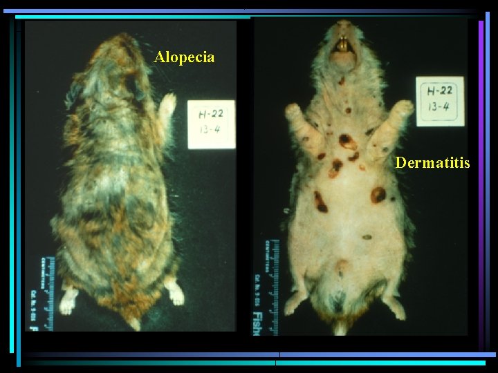 Alopecia Dermatitis Alopecia Dermatitis