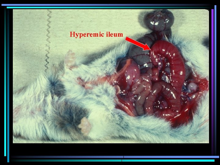 Hyperemic ileum Hyperemic ileum
