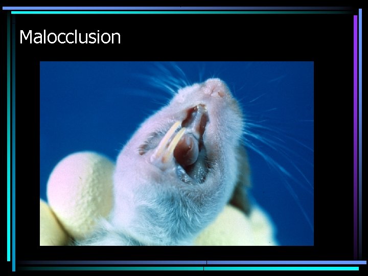 Malocclusion Malocclusion