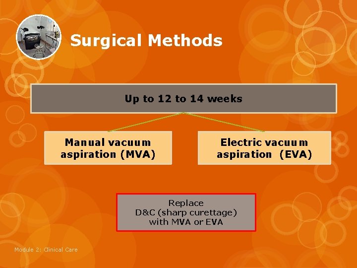 Surgical Methods Up to 12 to 14 weeks Manual vacuum aspiration (MVA) Electric vacuum