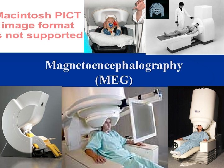 Magnetoencephalography (MEG) 