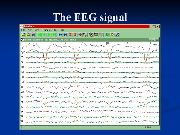 The EEG signal 