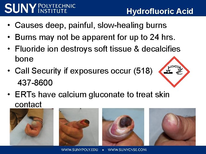  • • • Hydrofluoric Acid (HF) Causes deep, painful, slow-healing burns Burns may