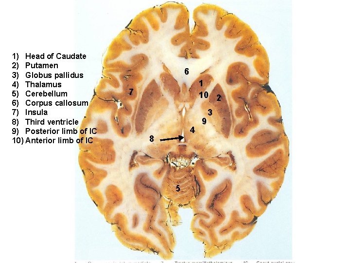 1) Head of Caudate 2) Putamen 3) Globus pallidus 4) Thalamus 5) Cerebellum 6)
