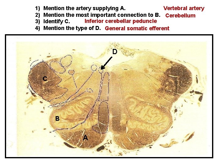 1) 2) 3) 4) Mention the artery supplying A. Vertebral artery Mention the most