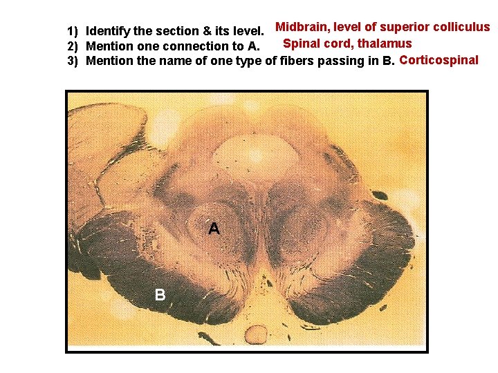 1) Identify the section & its level. Midbrain, level of superior colliculus Spinal cord,