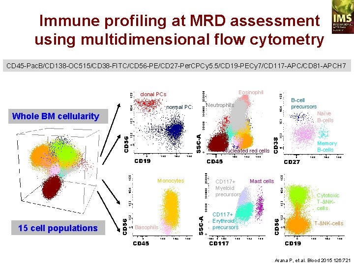 Immune profiling at MRD assessment using multidimensional flow cytometry CD 45 -Pac. B/CD 138