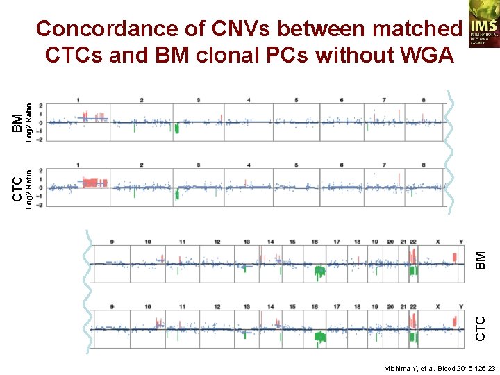 BM CTC BM Log 2 Ratio CTC Log 2 Ratio Concordance of CNVs between