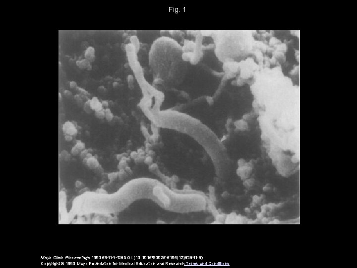 Fig. 1 Mayo Clinic Proceedings 1990 65414 -426 DOI: (10. 1016/S 0025 -6196(12)62541 -5)