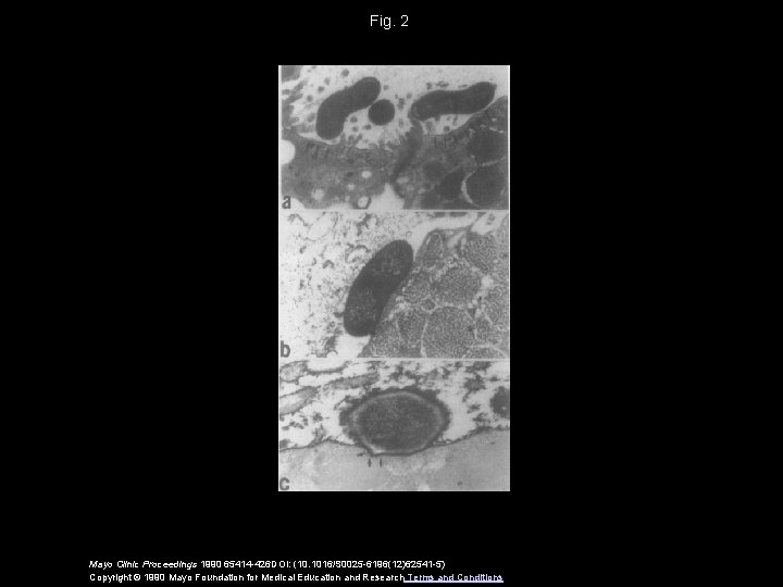 Fig. 2 Mayo Clinic Proceedings 1990 65414 -426 DOI: (10. 1016/S 0025 -6196(12)62541 -5)