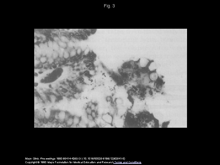 Fig. 3 Mayo Clinic Proceedings 1990 65414 -426 DOI: (10. 1016/S 0025 -6196(12)62541 -5)