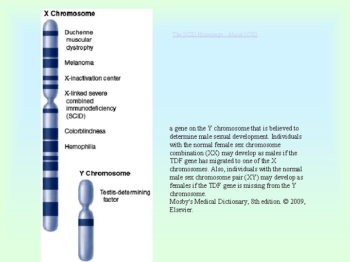 The SCID Homepage - About SCID a gene on the Y chromosome that is