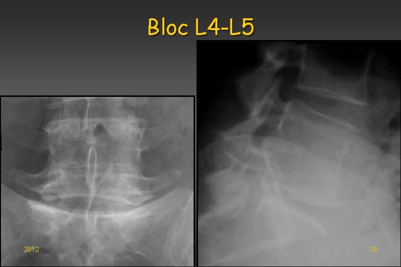 Bloc L 4 -L 5 2012 26 