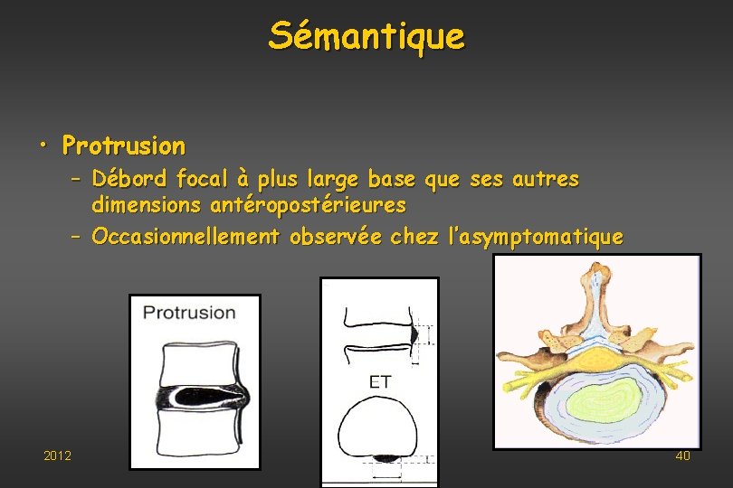 Sémantique • Protrusion – Débord focal à plus large base que ses autres dimensions