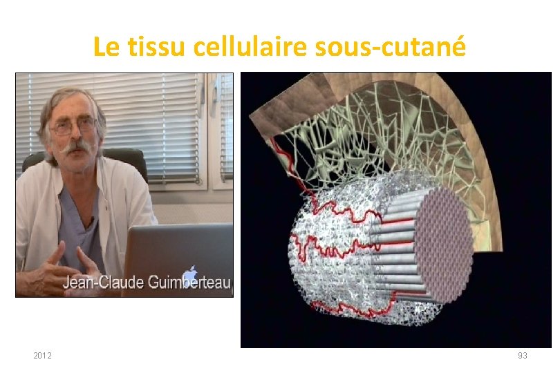 Le tissu cellulaire sous-cutané 2012 93 