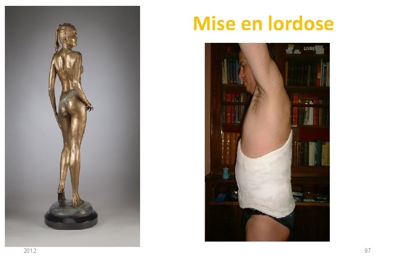 Mise en lordose 2012 97 