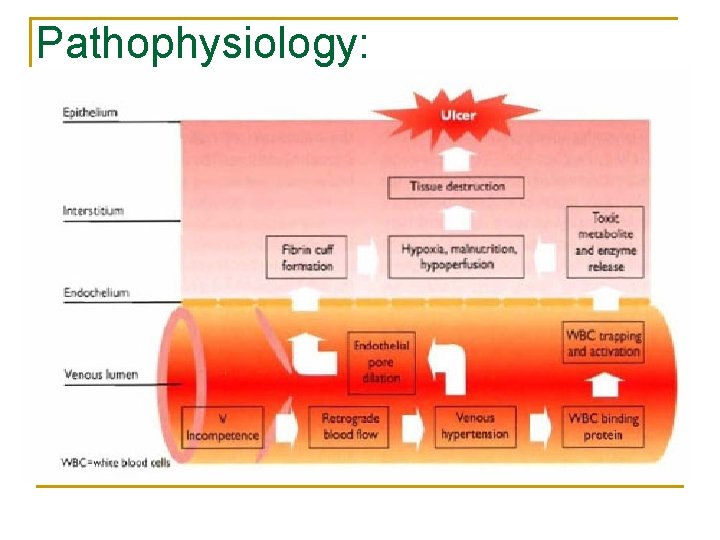 Pathophysiology: 