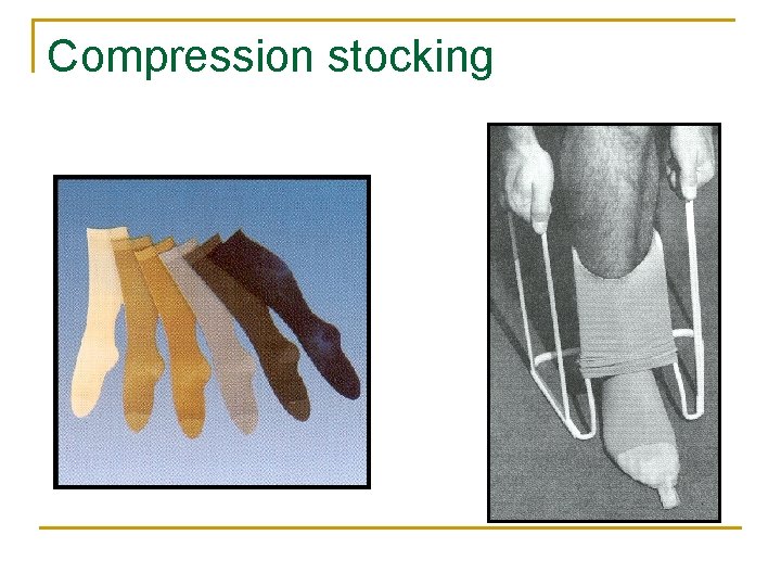 Compression stocking 