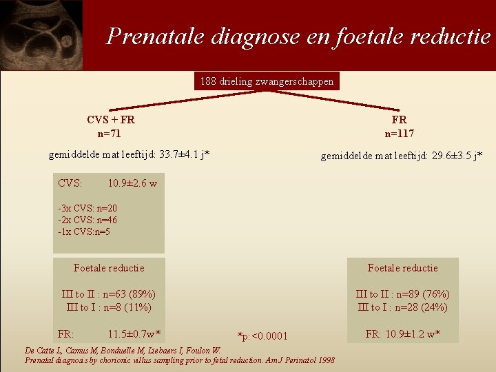 Prenatale diagnose en foetale reductie 188 drieling zwangerschappen CVS + FR n=71 FR n=117