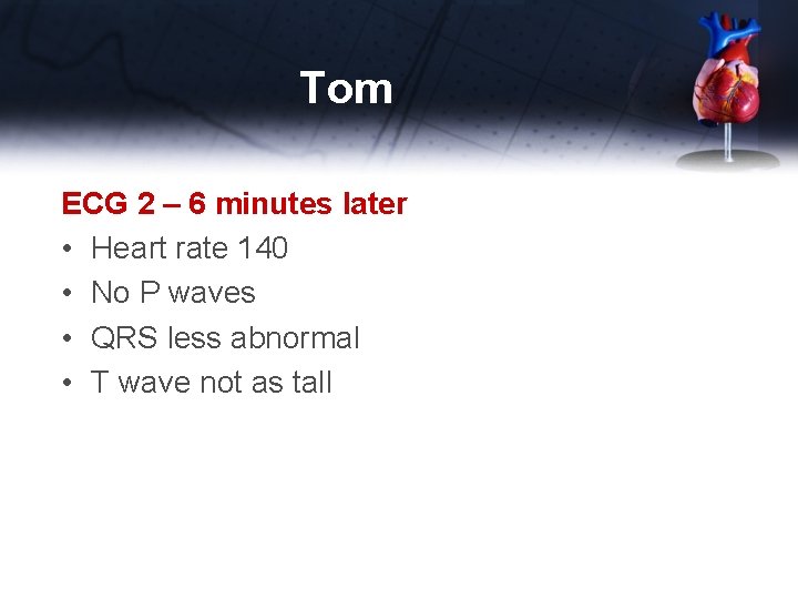 Tom ECG 2 – 6 minutes later • Heart rate 140 • No P