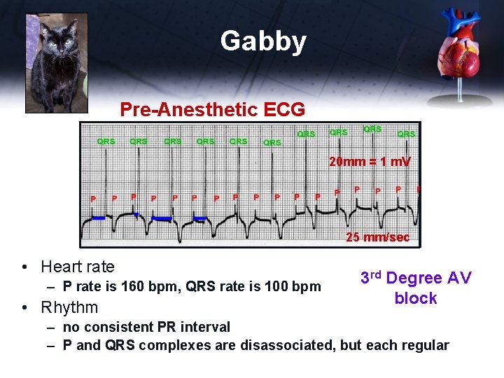 Gabby Pre-Anesthetic ECG 20 mm = 1 m. V 25 mm/sec • Heart rate