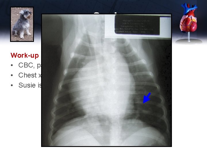 Susie Work-up • CBC, panel, electrolytes, UA normal • Chest x-rays • Susie is