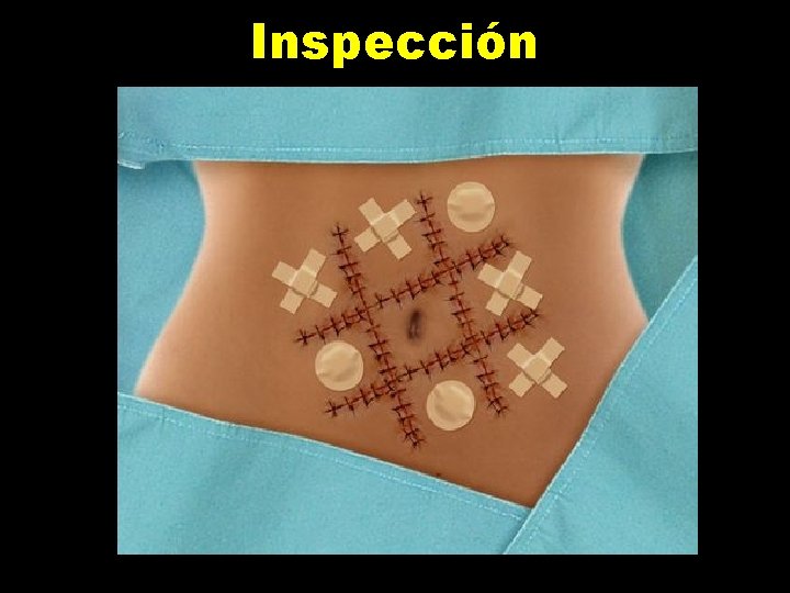 Inspección 