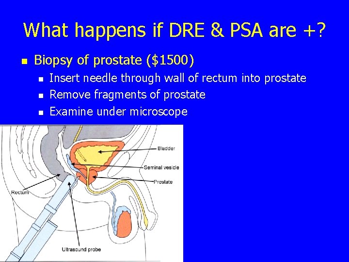 What happens if DRE & PSA are +? n Biopsy of prostate ($1500) n