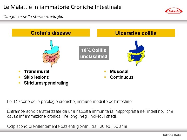 Le Malattie Infiammatorie Croniche Intestinale Due facce della stessa medaglia Crohn’s disease Ulcerative colitis