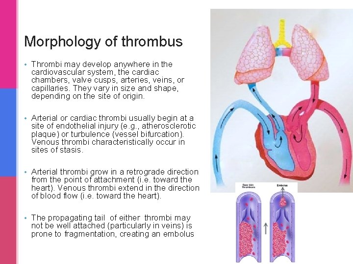 Morphology of thrombus • Thrombi may develop anywhere in the cardiovascular system, the cardiac