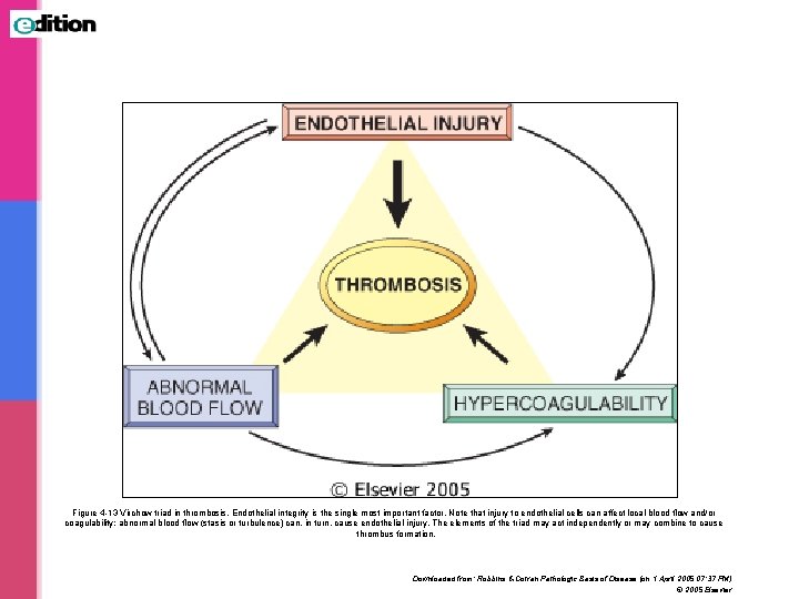 Figure 4 -13 Virchow triad in thrombosis. Endothelial integrity is the single most important