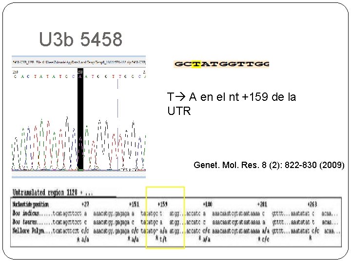 U 3 b 5458 T A en el nt +159 de la UTR Genet.